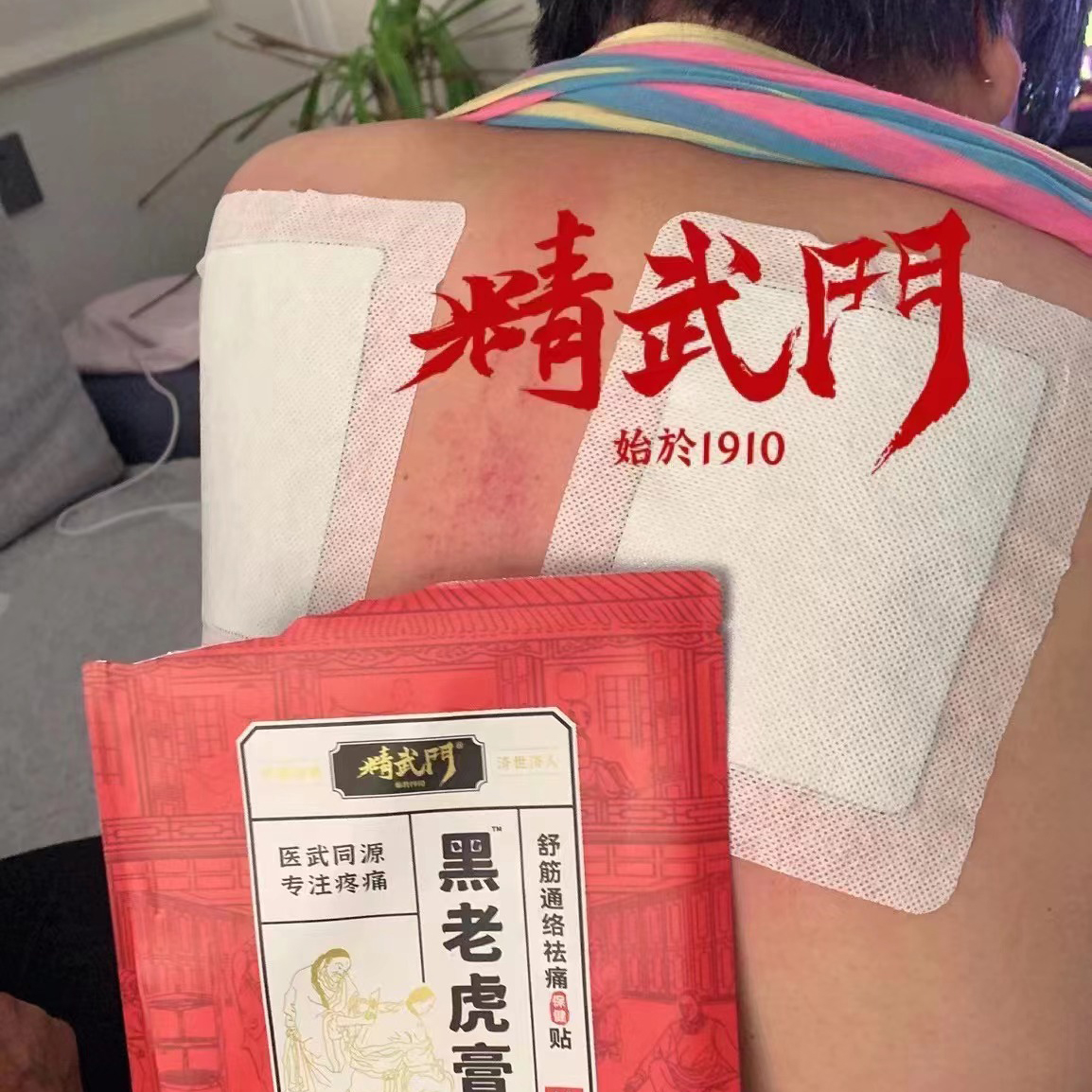 精武门黑老虎膏使用案例