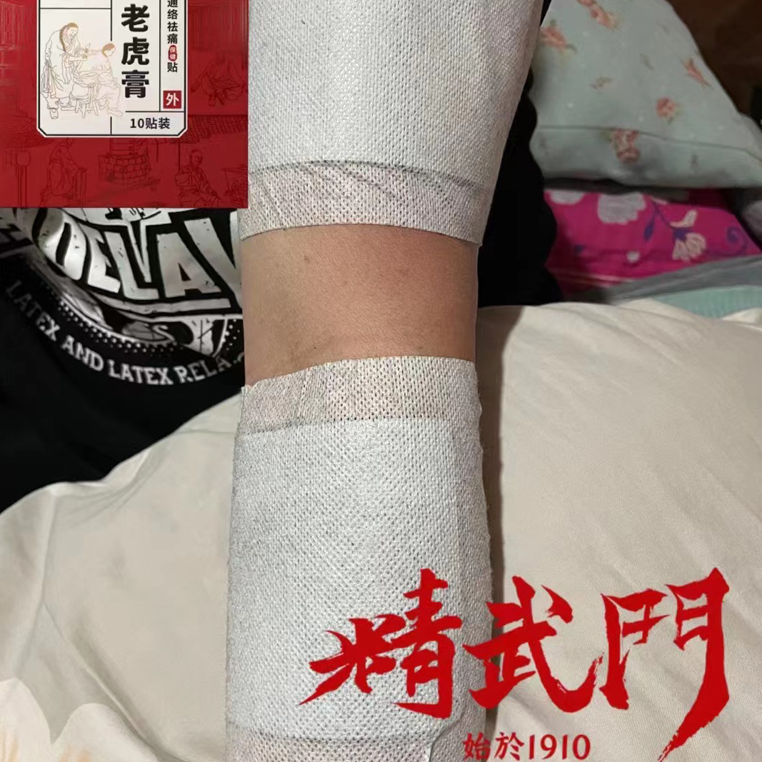 精武门黑老虎膏使用案例
