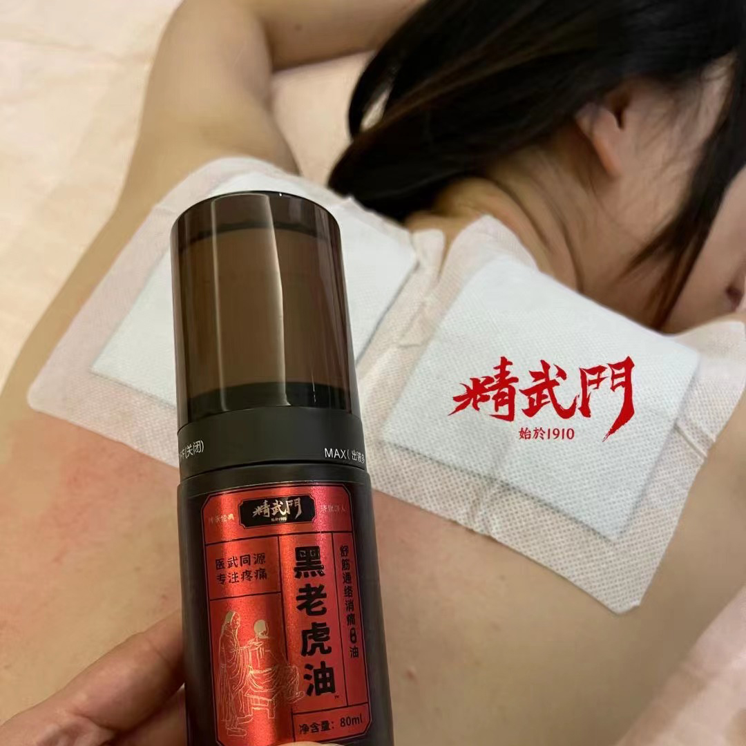 精武门黑老虎膏使用案例